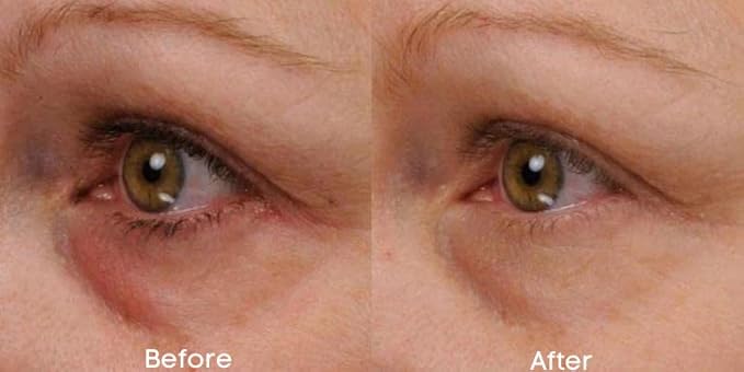 Renew & Firm Eye Serum-VivaGrace Women