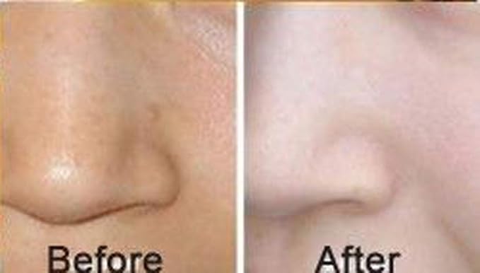 Luxurious 24k Gold Bio-collagen Facial Mask (5pcs)-VivaGrace Women