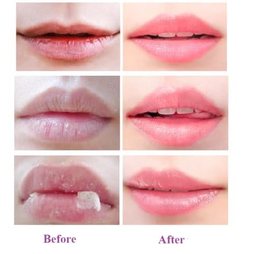 4 Pcs Lip Balm, Moisturizing Restors Moisture Bee Lip Mask for Dry Lips Lip Mask.(Honey)-VivaGrace Women