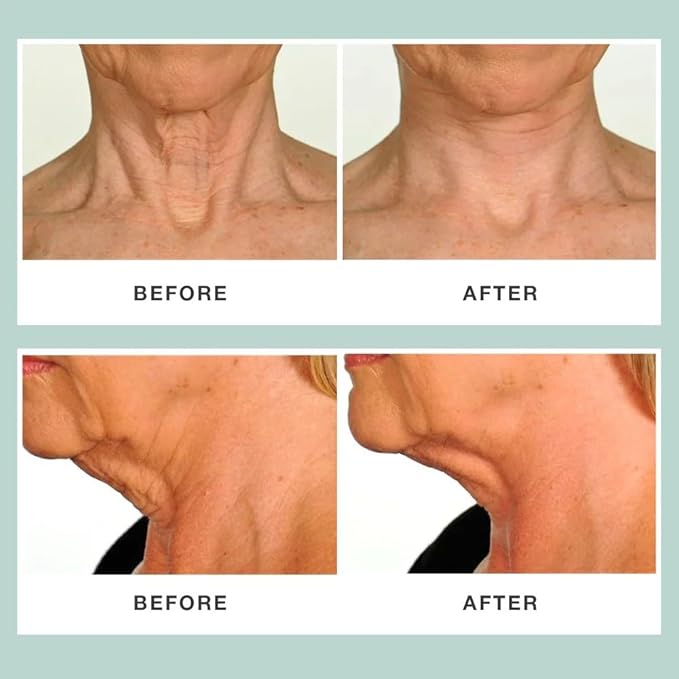 Neck Rescue Instant Correcting Strips – Invisible Lift Tape for Turkey Neck, Sagging Skin, and Wrinkles | Face & NeckTape Lifting for a Smooth, Tight Neckline – Long-Lasting Hold, 30 Count
