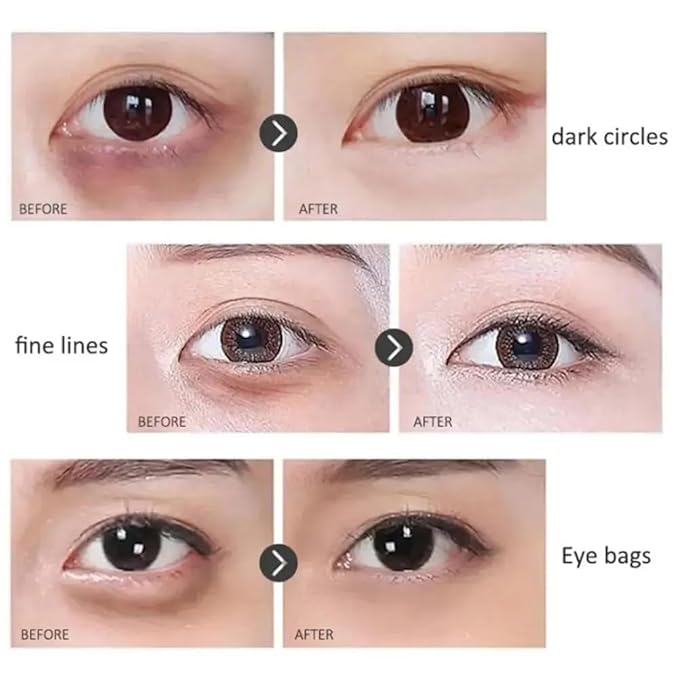 Time Eraser Rollerball, Retinol Anti-Wrinkle Eye Serum Oil, Eye Oil Roller, Reduces Fine Lines, Anti Wrinkle Serum For Eye-VivaGrace Women