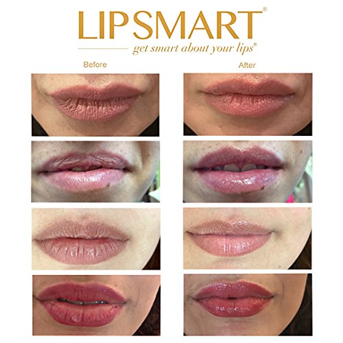 Ultra Hydrating Lip Treatment Moisturizer and Volumizer - Powerful Hydration for Dry Lips (1)