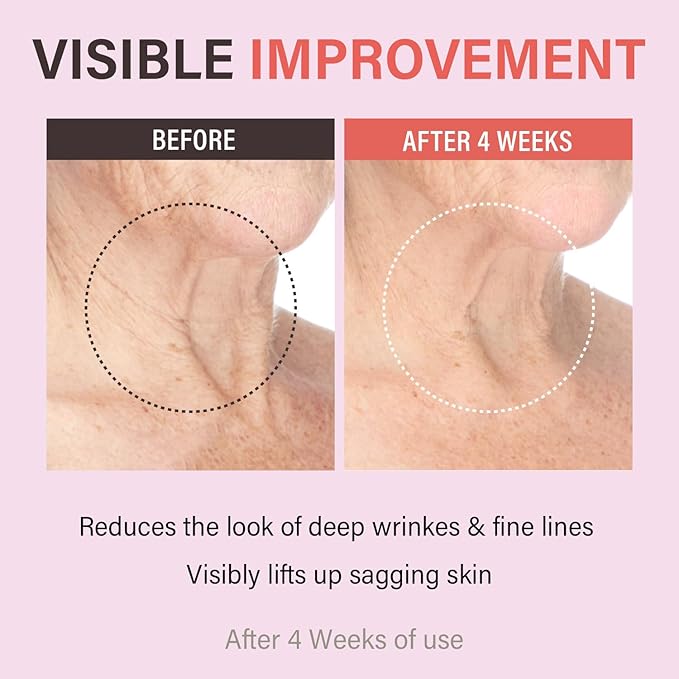Retinol Collagen Lifting Neck Cream,Anti Aging Face and Neck Cream for Reduce Wrinkles and Hydrating & Lifting Neck,For Face, Neck, Décolleté Wrinkle Care, 1.76 oz.-VivaGrace Women