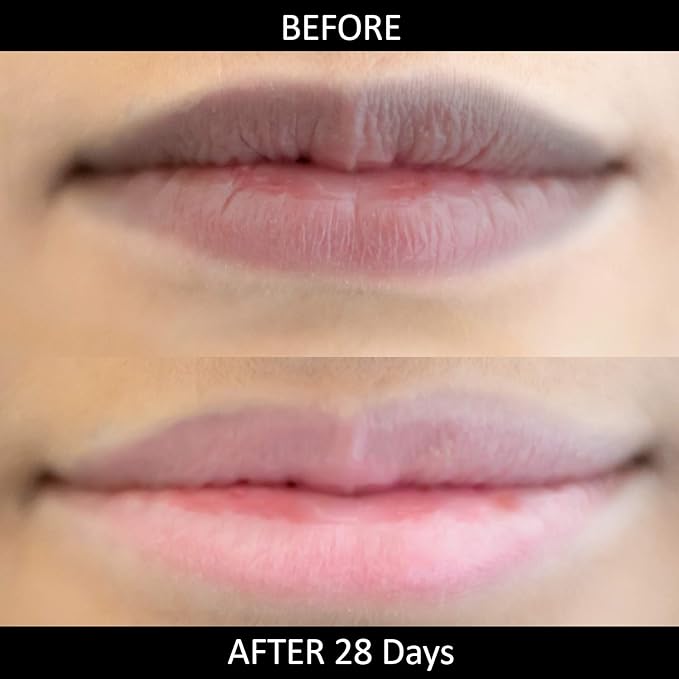 Omorfee 100% Organic Lip Lightening Stick for Dark Lips, Lip Whitening Lipstick with SPF, Natural Lip Balm Protection & Repair, Cocoa Butter, Carrot Seed Oil & Pineapple Extract - 6 Grams/0.21 Oz-VivaGrace Women