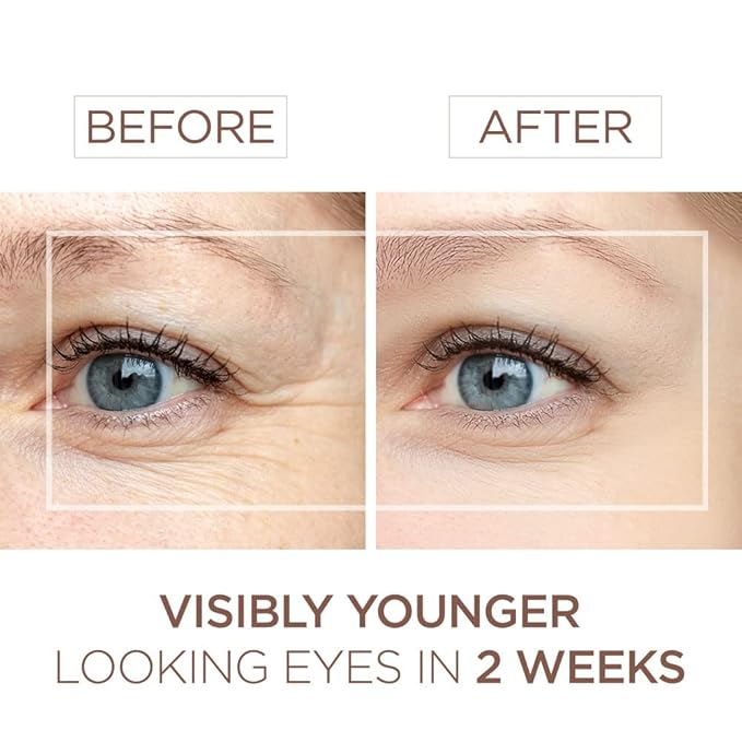 BEE and YOU Eye Cream, Anti Aging, Anti Wrinkle Serum 100% Natural with Bee Venom, Propolis Extract, Raw Honey, Hyaluronic Acid, For Dark Circles Under Eye Treatment and Puffiness, Skin Care, 15ml-VivaGrace Women