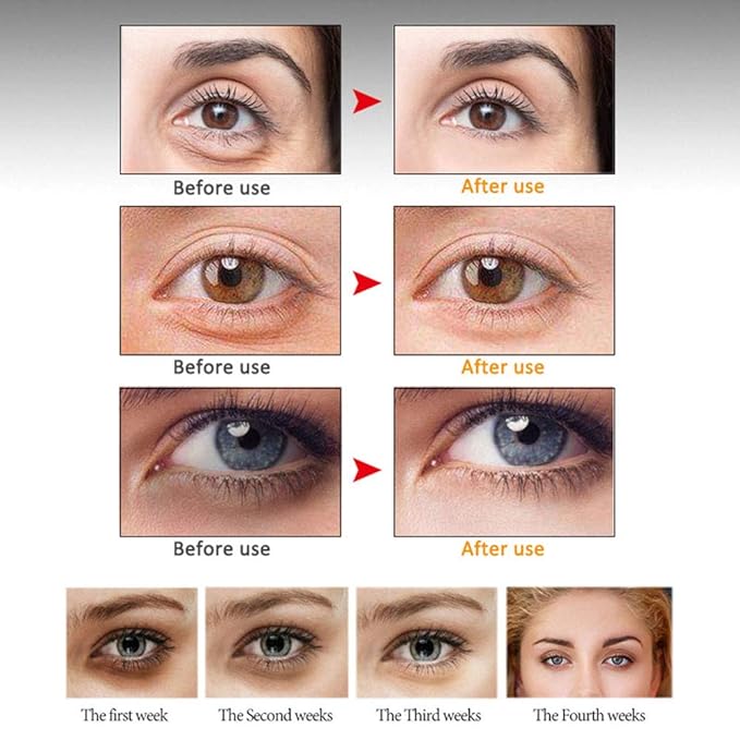 Eye Peptide Serum Eye Massage Roller Nourishing Relieve Loose Eye Bags Dark Circles Eye Skin Care Under Eye Cream for Fine Wrinkles and Puffiness Daily Skincare(Nourishing Grey)-VivaGrace Women