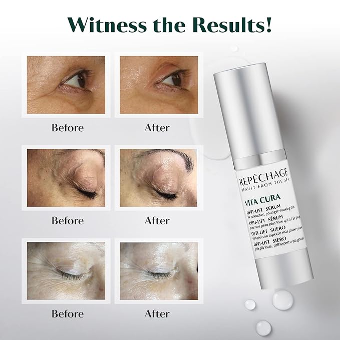 Repechage Vita Cura Opti-Lift Serum - Anti Aging Eye Contour Lifting Effect to Smooth Out Look of Wrinkles and Crow's Feet with Almond Protein, Seaweed Extracts, and Peptides, 15ml /0.5fl oz.-VivaGrace Women