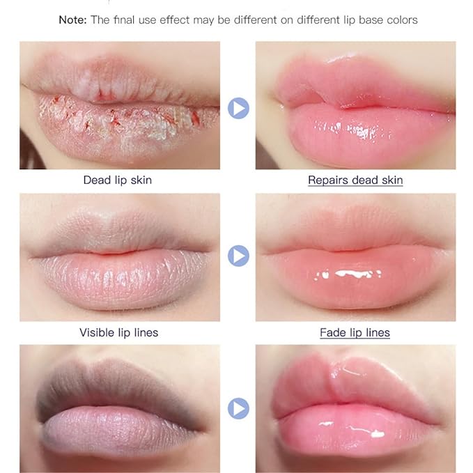 Lip Repair Gel, Moisturizing Lip Repair Soft Moisturizing Lip Care, Soothe & Protect Lip Balm.-VivaGrace Women