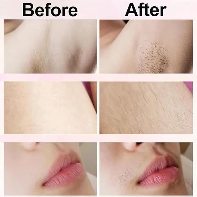 Dermave Bikini Shaver,2 in 1 Dual Head Bikini Trimmer & Body Shaver, Painless Hair Removal with Silky Glow Finish, Cordless & Waterproof Electric Trimmer for Women,Blue-VivaGrace Women