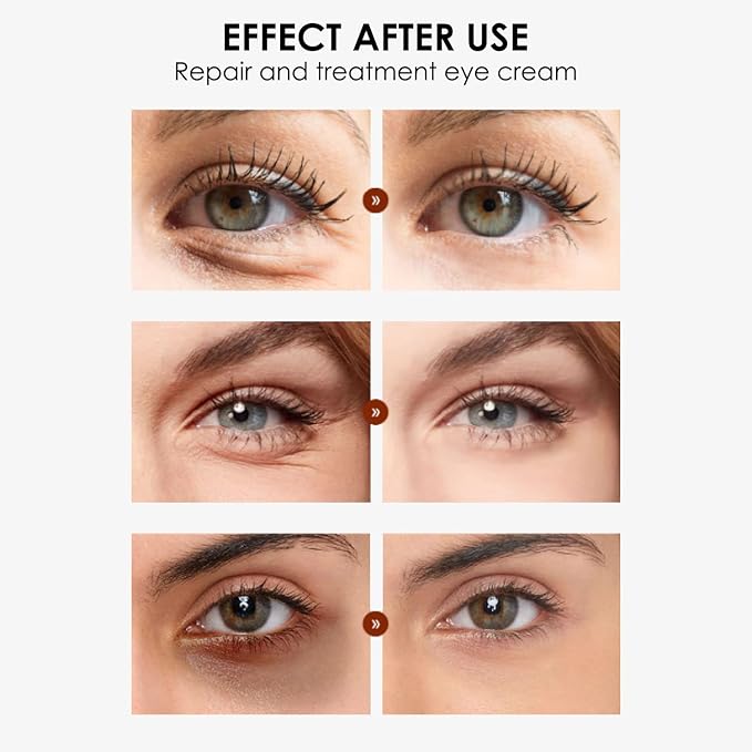 Eye Cream, STCORPS7 Vibrant Glamour Silk Protein Anti-Wrinkle And Firming Eye Cream For Wrinkles, Fine Lines, Dark Circles, Puffiness & Bags, 20g-VivaGrace Women