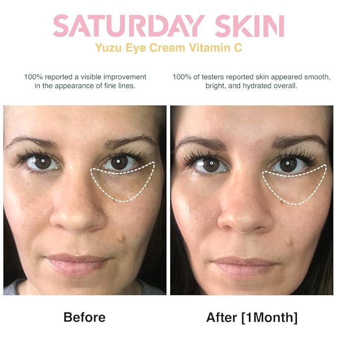 Saturday Skin Yuzu Eye Balm Vitamin C Wide lluminating Under Tight Eye Cream Korean Niacinamide Caffeine for Wrinkles Puffy Eyes Dark Circles Moisturizing Hydrates Anti Aging for Women (15ml)-VivaGrace Women