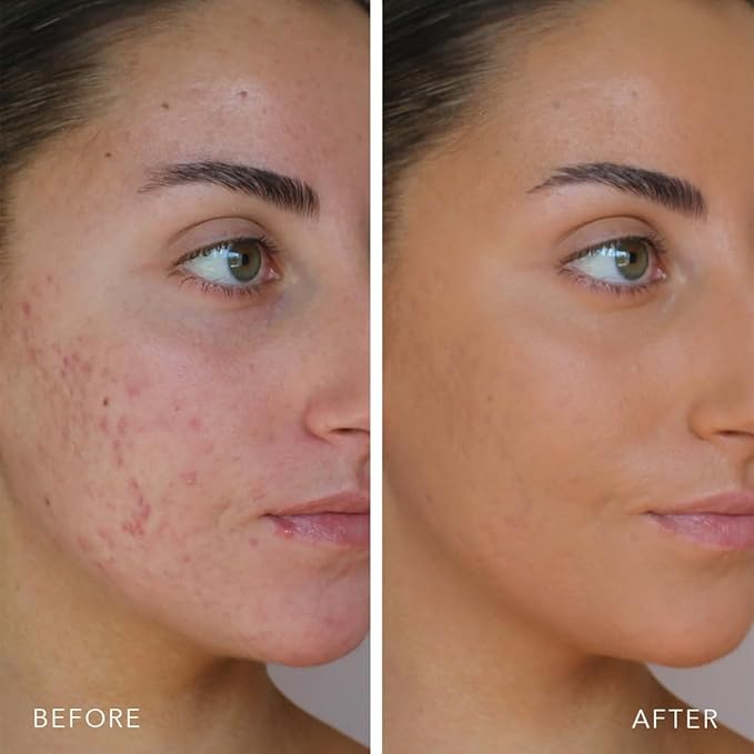 Doll 10 TCE Liquid Filter - Covers, Blurs, and Brightens (Deep/Rich)-VivaGrace Women