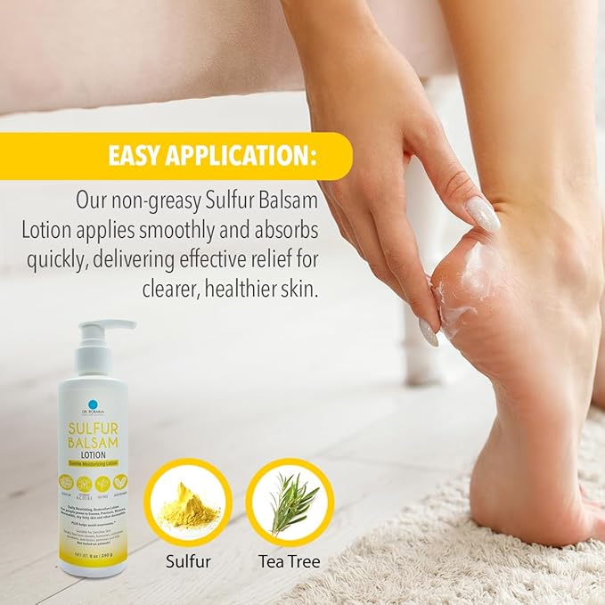 Dr. Robaina Sulfur Balsam Lotion – Lightweight Moisturizer for Dry, Flaky & Itchy Skin – Calms Redness, Supports Skin Barrier & Locks Hydration – Shea Butter & Tea Tree – 8 fl oz, USA Made-VivaGrace Women