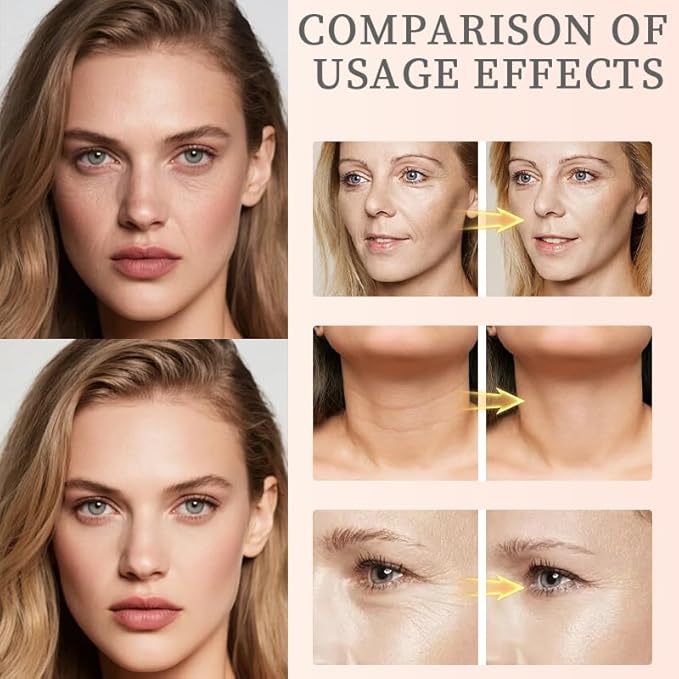 Xianjina Polypeptide Collagen Elastic Essence Cream - Micro-Molecular Anti-Wrinkle Firming Lotion, Tightening & Lifting Sagging Skin for Face, Moisturizing Anti-Aging Treatment (2 Pack)-VivaGrace Women