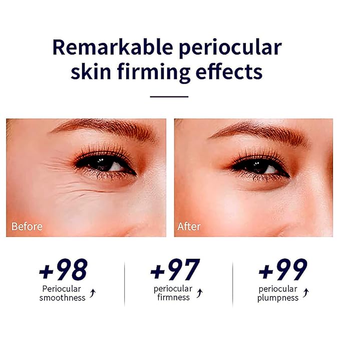 Snail Peptide Advanced Under Eye Cream for Dark Circles, with 360° Massage Ball Reduces Wrinkles &Fine Lines, Eye Essence Roll-On, Firms, Moisturizes, and Tightens Puffy Eyes for Men&Women-VivaGrace Women