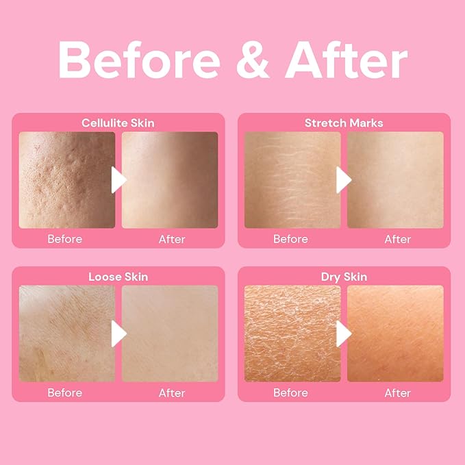 Enaskin Naturals Anti Cellulite Cream: Skin Firming and Tightening Lotion for Booty, Legs & Belly - Lifting Body Mask for Women Loose Skin, Lift & Firm Moisturizing Bum Bum Care-VivaGrace Women