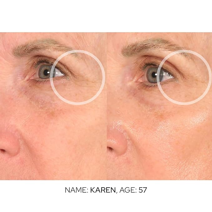 SiO Cooling Cryo Eye Cream - Anti-Aging, Hydrating Under Eye Concentrate Formulated For Targeting Dark Circles, Fine Line, Wrinkles, Puffiness & Bags-VivaGrace Women