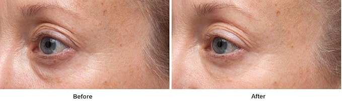 Dr. Dennis Gross Ferulic + Retinol Triple Correction Eye Serum: for Wrinkles, Loss of Elasticity, and Rough Texture, 0.5 fl oz-VivaGrace Women