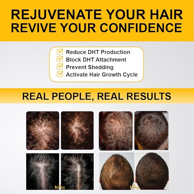 Revivogen MD Scalp Therapy Thinning Hair Solution, Shampoo & Conditioner Set-VivaGrace Women