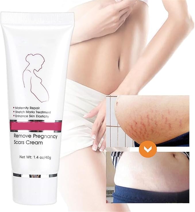 RtopR Stretch Marks and Scar Cream,Crema para Estrias De Embarazo,Stretch Marks Postpartum Repairing Cream Wrinkles Diluting Removal Cream Crema De Cacao para Cicatrices-VivaGrace Women