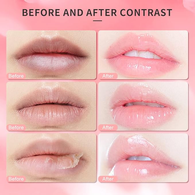 Lip Scrub, Lip Scrubs Exfoliator Moisturizer Dr.YIMAN Sugar Lip Scrub, Lip Exfoliator Scrub for Dry and Chapped Lips,Anti-Aging and Temping, Lip Mask, Lip Care Products, Lip Scrubber, Lip Moisturizer-VivaGrace Women