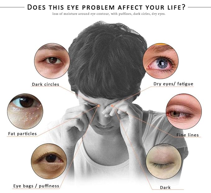 Eye Peptide Serum Eye Massage Roller Nourishing Relieve Loose Eye Bags Dark Circles Eye Skin Care Under Eye Cream for Fine Wrinkles and Puffiness Daily Skincare(Nourishing Grey)-VivaGrace Women