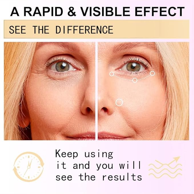 Snail Peptide Eye Cream for Dark Circles, Puffiness and Wrinkle, Snail Mucin & Nicotinamide, Moisturizing, Hydrating, Firming, Massage Ball, 17ml-VivaGrace Women