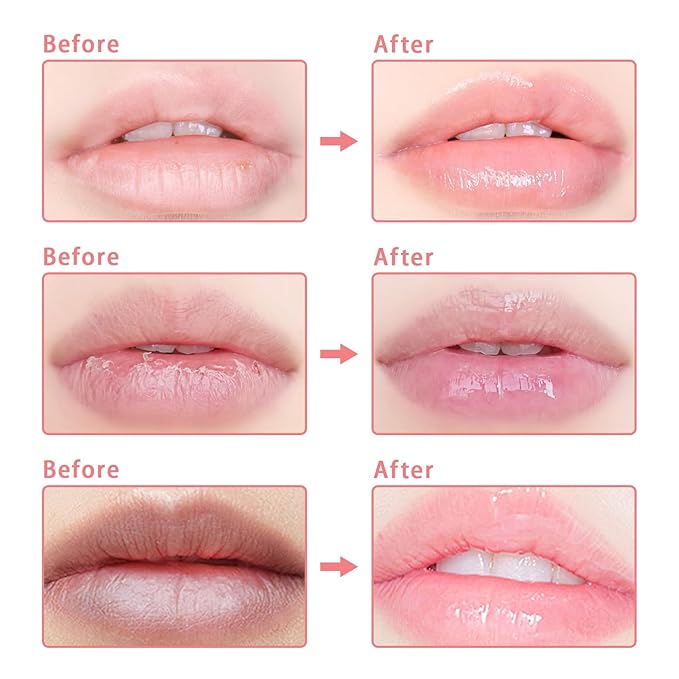 3 Pcs Bee Lip Balm Honey Pot, Coconut Watermelon Apple Lime Lip Mask Overnight, Moisturizing Lip Sleeping Mask, Hydrate Repair Prevent Dry Cracked Lip Exfoliator (Coconut +Watermelon+Apple Lime)-VivaGrace Women