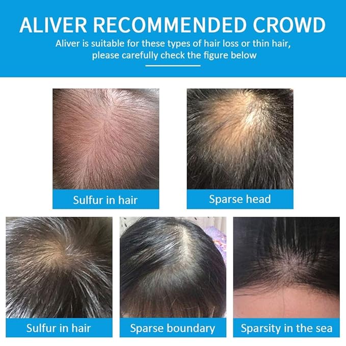 Aliver Hair Fibers for Thinning Hair with Spray Dark Brown - Undetectable Natural Formula - Thicker Fuller Hair in 15 Seconds - Conceals Hair Loss & Look Younger - Designed for Men & Women,0.97Oz-VivaGrace Women
