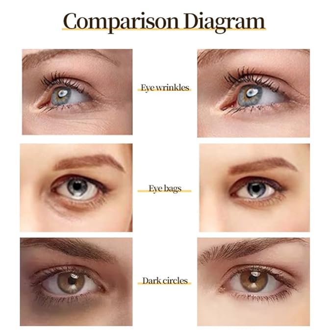 Generic 24 K Gold Eye Mask Puffy Eyes and Dark Circles Treatment Relieve Pressure and Reduce Wrinkles, Revitalize and Refresh Your Skin-VivaGrace Women