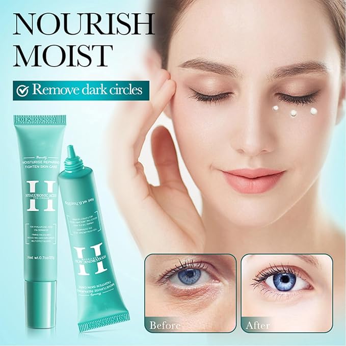2 PCS Hyaluronic Acid Repair Eye Cream for Dark Circles,Bags Under and Puffiness,Eye Wrinkle Firming Cream Moisturise Repairing Thghten Eye Skin Care-VivaGrace Women
