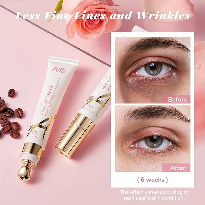 ANAI RUI Rose Caffeine Eye Cream for Dark Circles, Under Eye Serum for Puffiness Bags, Anti-Aging Eye Cream with Retinol, Collagen, Hydrating, Firming, Reduce Wrinkles and Fine Lines Daily 0.5 FL OZ-VivaGrace Women