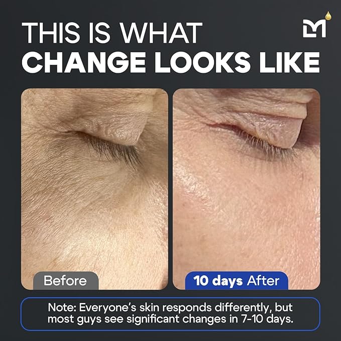 Titan Anti-Aging Peptides Serum for Face – High Potency Mens Peptide Serum Moisturizer – Mens Skin Care – Men, Dark Spots, Wrinkles, Fine Lines – Peptides, 5% Niacinamide, HA – Unscented-VivaGrace Women