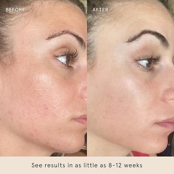 Barefaced Serum Duo - RetinAL & Liquid Gold to Hydrate, Even Skin Tone, & Reduce Signs of Aging-VivaGrace Women