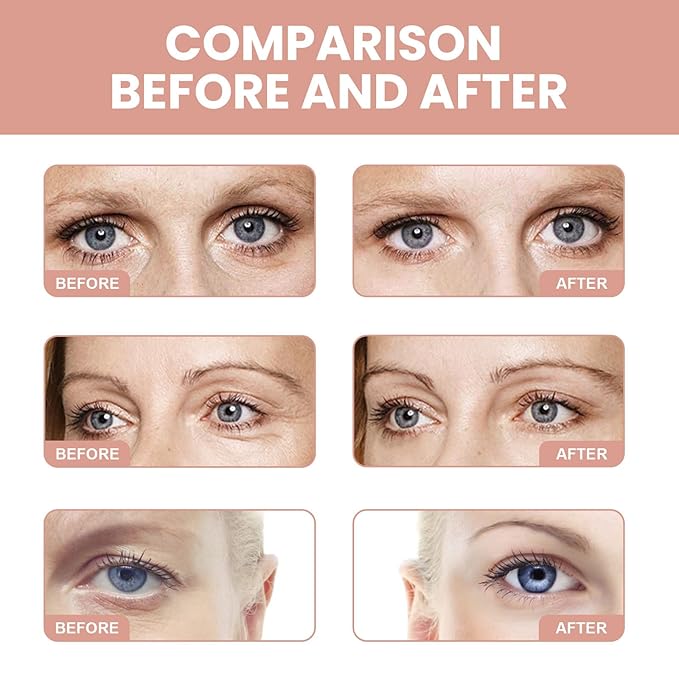 Retinol Eye Stick, Retinol Eye Cream for Dark Circles and Puffiness, Under Eye Cream Anti Aging, Retinol Eye Balm Reduce Fine Lines and Dark Circles, Visible Results in 3-4 Weeks-VivaGrace Women