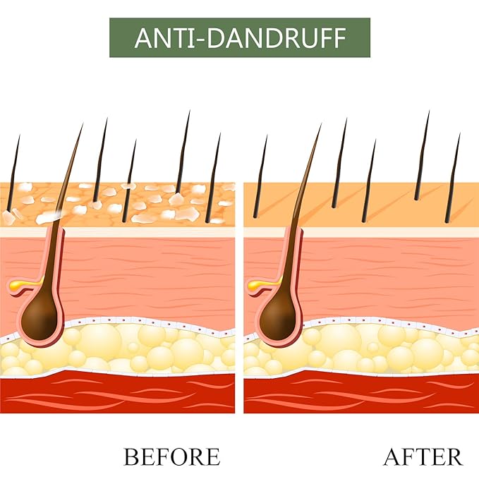 Luseta Tea Tree & Argan Oil Detangling Shampoo & Conditioner Set, 2 x 33.8 Oz-VivaGrace Women