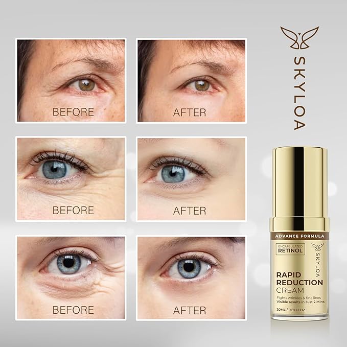 Retinol Eye Cream Anti Aging: Under Eye Cream for Dark Circles and Puffiness Bags - Retinol Eye Serum - Under Eye Serum with Caffeine and Hyaluronic Acid - Visibly Reduces Wrinkles Fine Lines(20ML)-VivaGrace Women