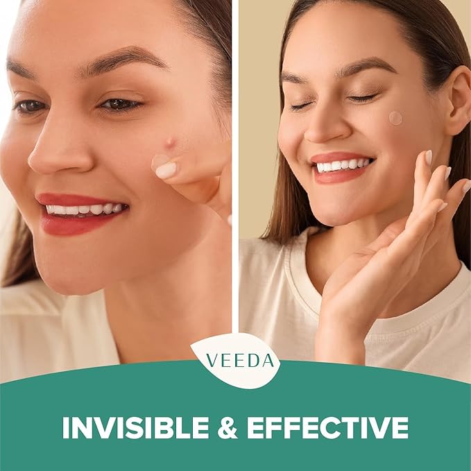 Veeda Glow Pimple Patches – Hydrocolloid Acne Stickers for Fast Healing, Invisible & Non-Irritating Zit Covers, Blemish Spot Treatment, 72 Count