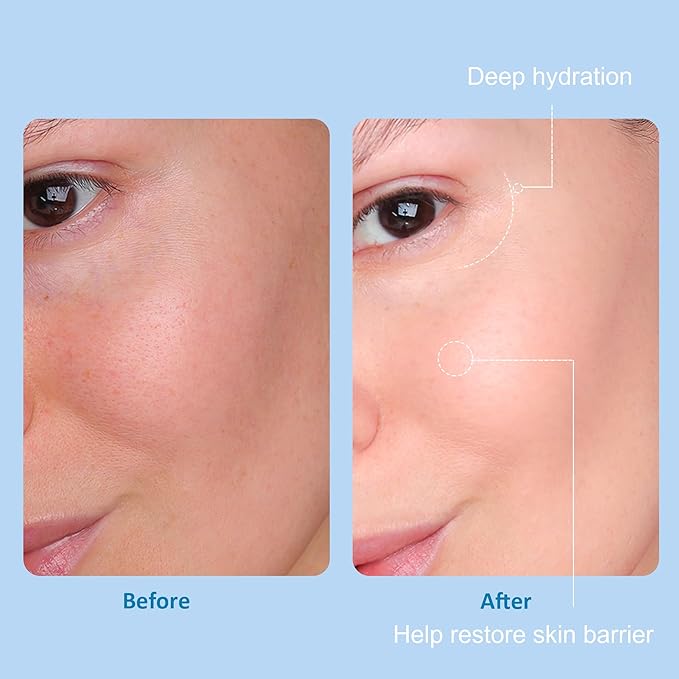 5 Step Skin Care Set, Large 17.6 Fl oz, All with Hyaluronic Acid Facial Skin Care Products, Makeup Remover, Cleanser, Toner, Serum, Lotion, Hydrating & Protect Skin, Sulfates & Paraben-Free-VivaGrace Women