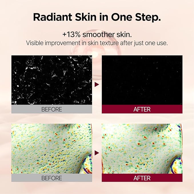 PONGDANG Nourishing Rice-Paste Wash-Off Mask | Gentle Exfoliation & Oil Control | Hydrating Care with Organic Rice Extract & Antioxidants | Helps Improve Skin Tone & Texture | Korean Skin Care-VivaGrace Women