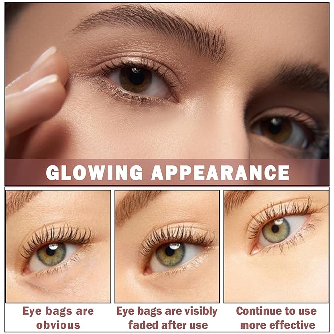 NVLEPTAP Eye Cream for Dark Circles and Puffiness Under Eye Cream for Wrinkles and Bags Reduce Wrinkles and Fine Lines Lift Firm Skin Around the Eyes-VivaGrace Women