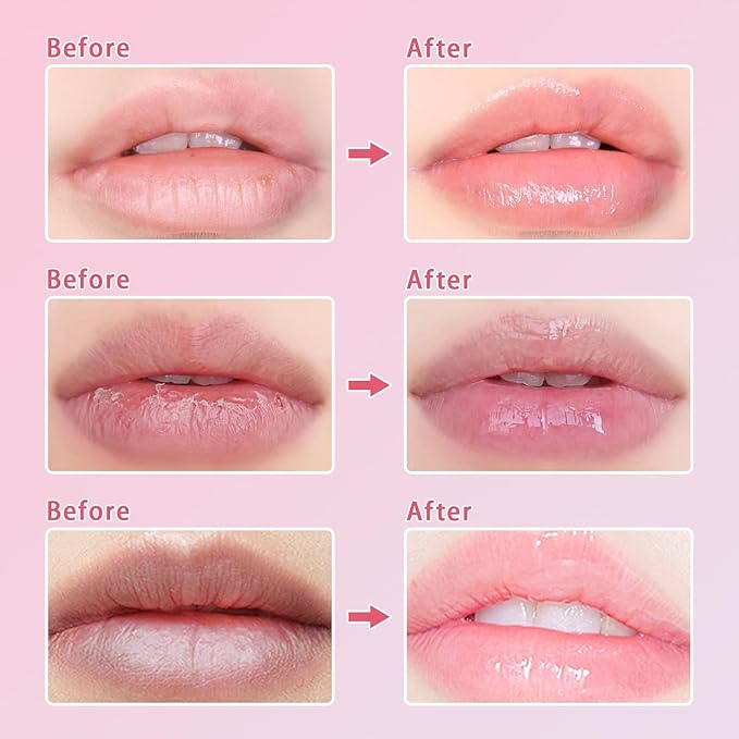 3 Pcs Bee Lip Balm Honey Pot, Cherry Watermelon Apple Lip Mask Overnight, Moisturizing Lip Sleeping Mask, Hydrate Repair Prevent Dry Cracked Lip Exfoliator Lip Care (Cherry+Watermelon+Apple Lime)-VivaGrace Women
