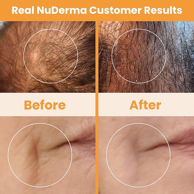 Pure Daily Care NuDerma Handheld Skin Therapy Wand Machine w/Neon – Anti-Aging - Skin Tightening - Wrinkle Reducing - Dark Circles – Clarifying - Hair & Scalp Stimulator-VivaGrace Women