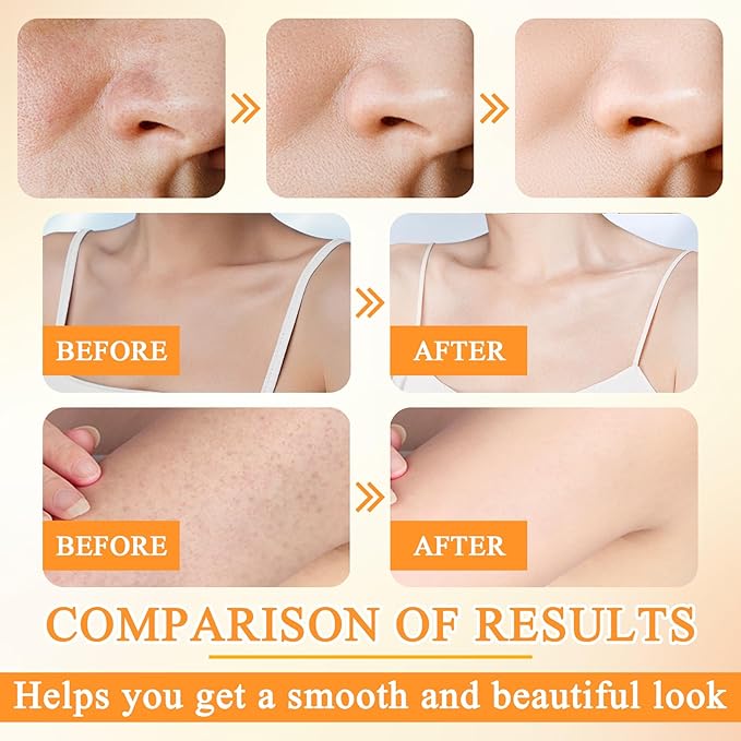 2PCS Orange Face Exfoliating Gel Scrub,Gentle Exfoliating Face Wash,Deep Cleansing Moisturizing Peeling Gel Face Scrub for All Skin Types