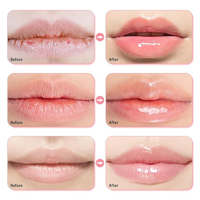3 Pcs Bee Lip Balm Honey Pot, Honey Strawberry Watermelon Lip Mask Overnight, Moisturizing Sleeping Lip Mask, Hydrate Repair Prevent Dry Cracked Lip Care (Honey+Strawberry+Watermelon)-VivaGrace Women