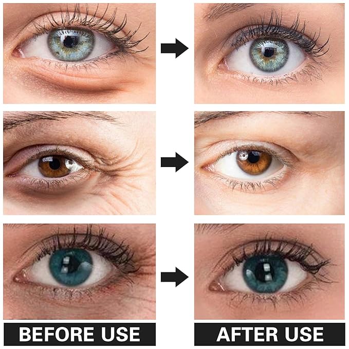 Eye Cream for Dark Circles Bags Eye Cream Eye Products Under Eye Bags Dark Circles-VivaGrace Women