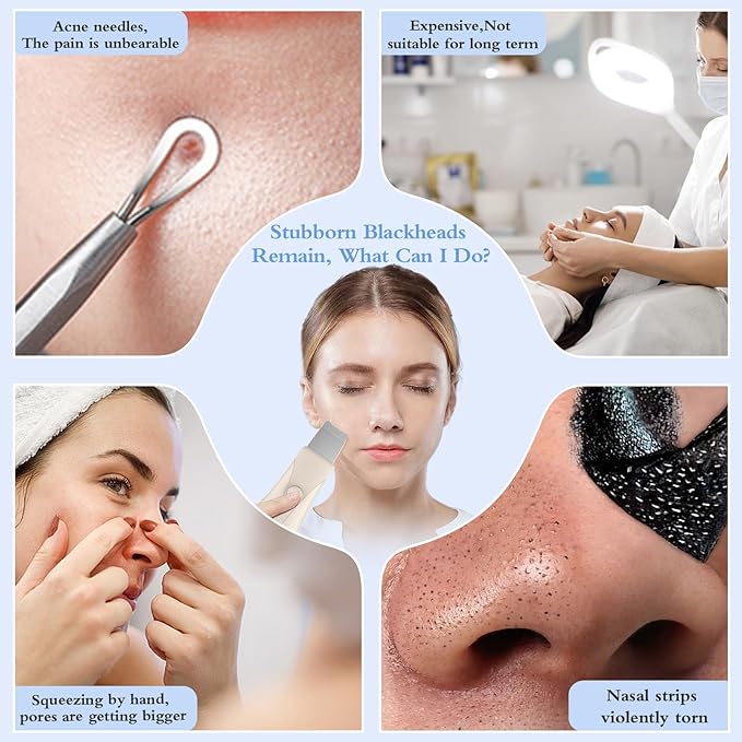 Skin Scrubber Face Spatula Skin Spatula Pore Cleaner Blackhead Remover Tools for Facial Deep Cleansing Skin Care Tool for Men and Women (Beige)-VivaGrace Women