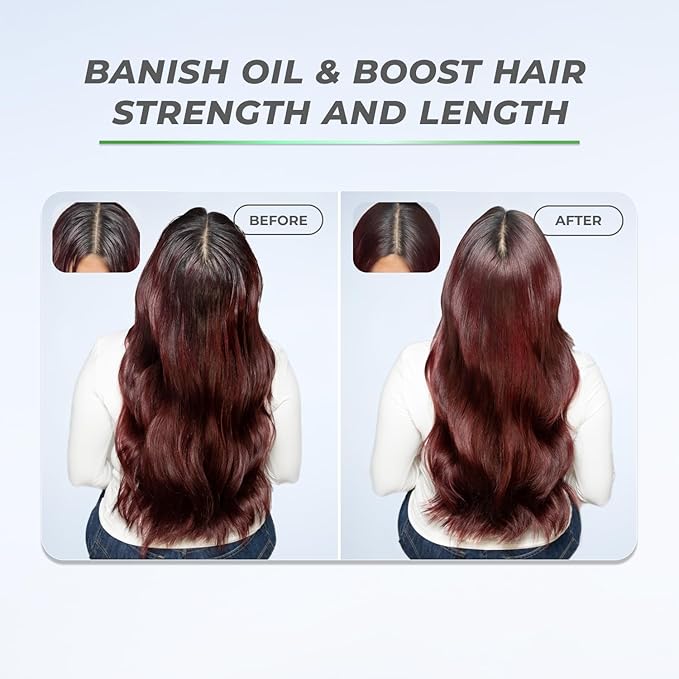 XMONDO Hair BOOST X Dry Shampoo, Zero Residue, Formulated with Saw Palmetto to Promote Scalp Care, Clinically Tested, Dermatologist Tested, Talc-free, Benzene-free, Free of aluminum starch, 5 oz-VivaGrace Women
