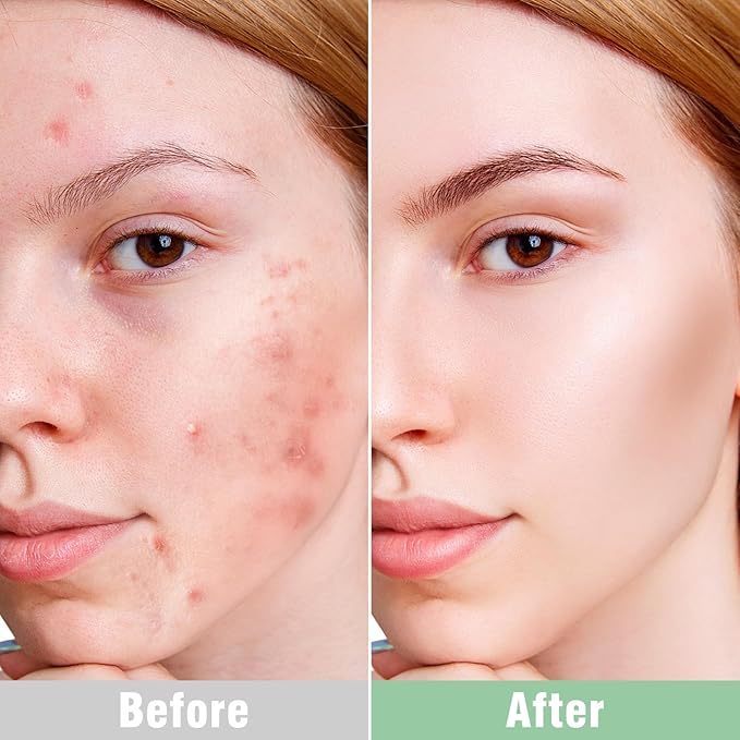 ISTON Overnight Hydrogel Face Mask for All Skin-VivaGrace Women