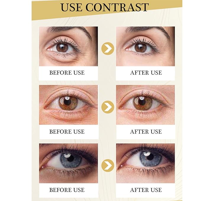 Polypeptide Eye Cream for Dark Circles,Bags Under and Puffiness,Polypeptide Eye Cream Anti Aging Firming Eye Cream,Wrinkie Removal Dark Circles Remove Eye Bags Nourishing Eye Serum Skin Care-VivaGrace Women